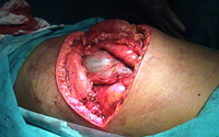 Best Kidney transplant Surgeon india, best kidney transplant hospital in punjab, Best urologist, super Specialist kidney surgeon chandigarh, mohali, panchkula, leading Uro oncologist ludhiana, HP, Baddi, Punjab, himachal, haryana